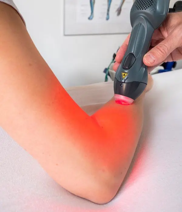 Laser behandling - ASA behandling af arm