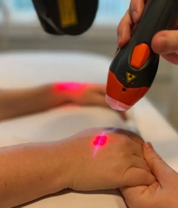 Laser behandling - ASA behandling ved behandling af gigt i fingrene